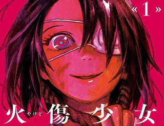 火伤少女漫画 23已完结 在线漫画 漫画人